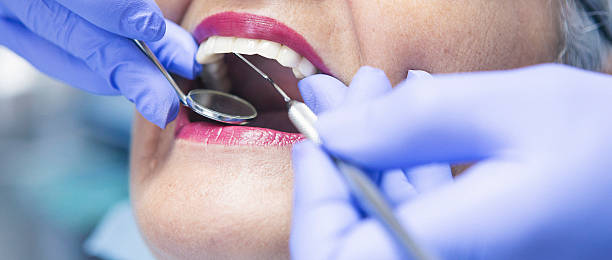 Best Emergency Wisdom Teeth Removal in Florin, CA